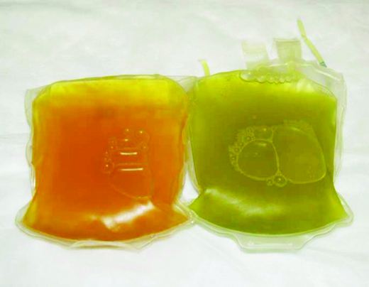 Ceruloplasmin carries more than 95% of the total copper in healthy human plasma and in addition plays a role in iron metabolism. It was first described in 1948.