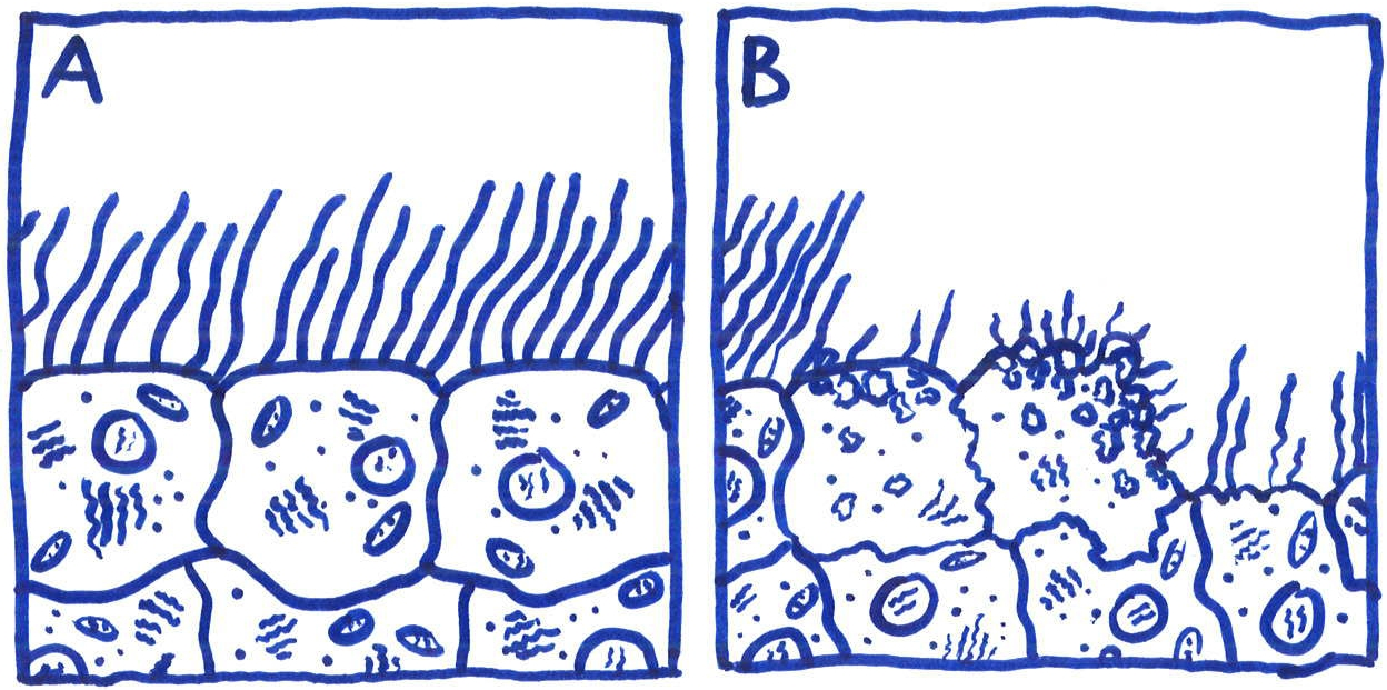 Tracheal cytotoxin (TCT) is a soluble piece of peptidoglycan (PGN) found in the cell wall of all gram-negative bacteria, but only some bacteria species release TCT including Bordetella pertussis, Vibrio fischeri, and Neisseria gonorrhoeae