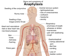 Albumen Prints and Egg Whites…All the Rage Back in the Day…and A Few Other Things