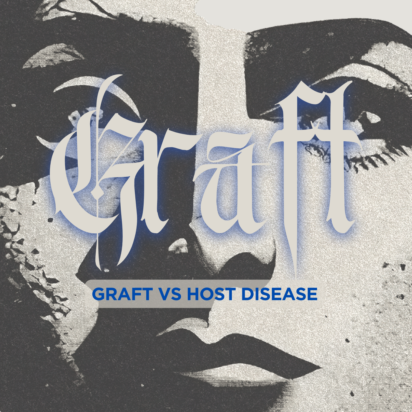 Graft-versus-host disease (GvHD) is divided into acute and chronic forms